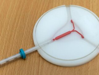 Metody Antykoncepcji Wewnątrzmaciczne – Wybór i Właściwości Systemów IUD